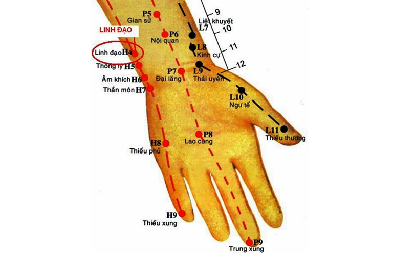 Huyệt nằm trên mặt trước trong của cẳng tay