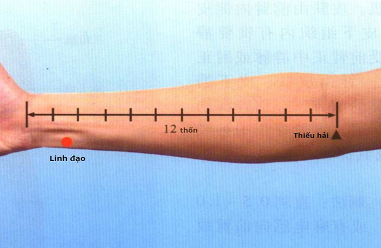 Hình ảnh minh họa huyệt Linh Đạo