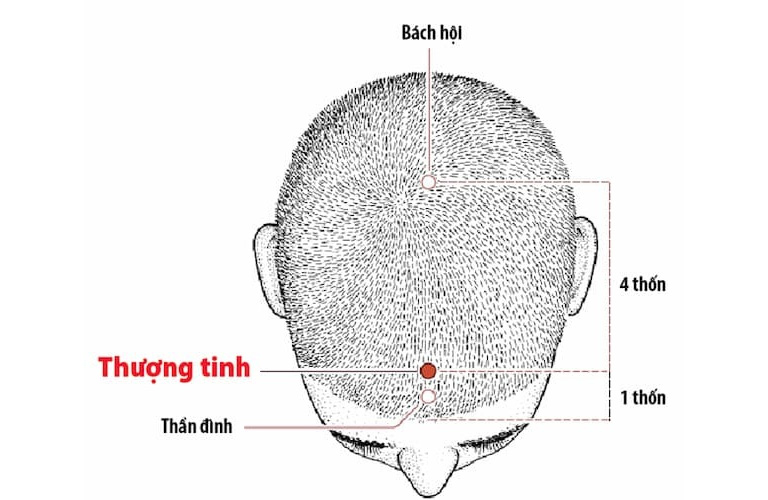 Hình ảnh minh họa Thượng Tinh huyệt